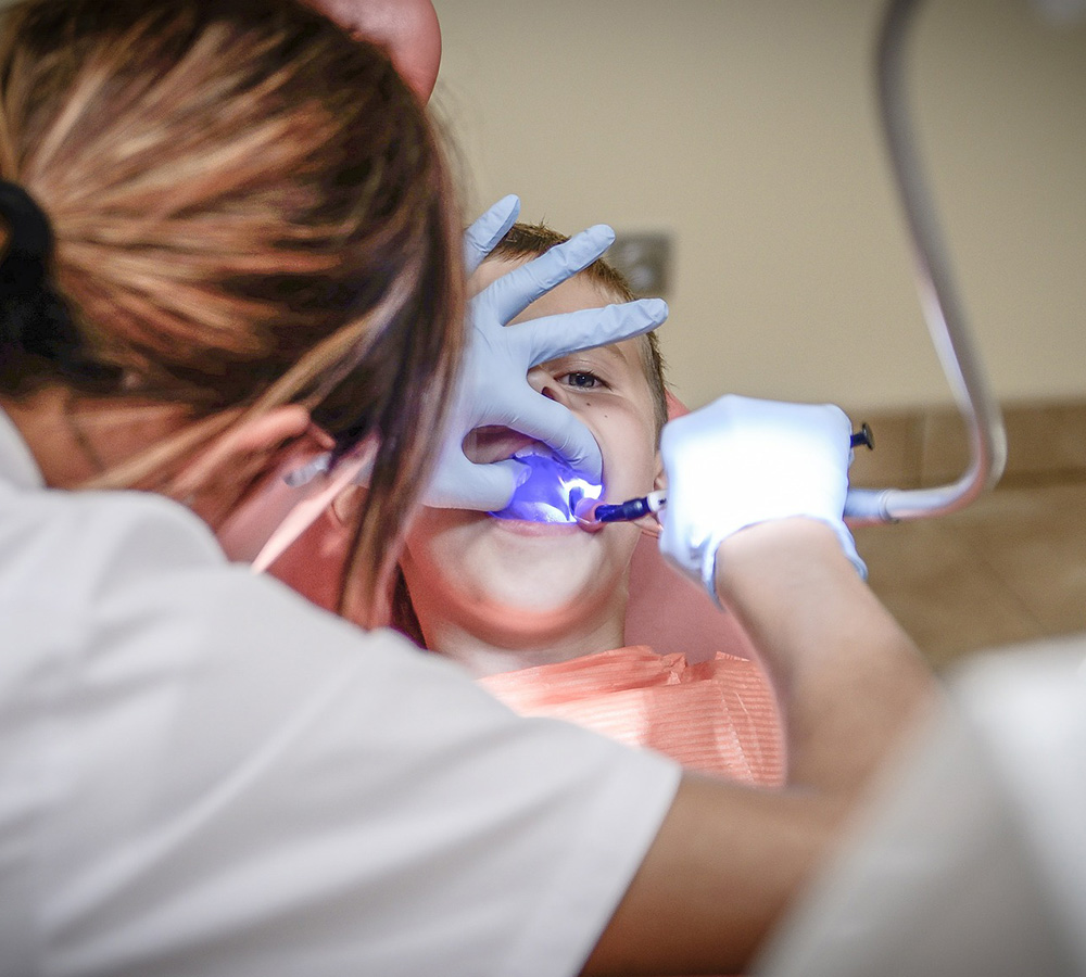 Can Dental Sealants Prevent Cavities?