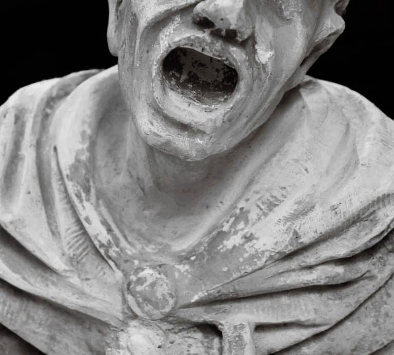 Rheumatoid Arthritis And The Jaw Nathalie Kadoch Dentist Lachine