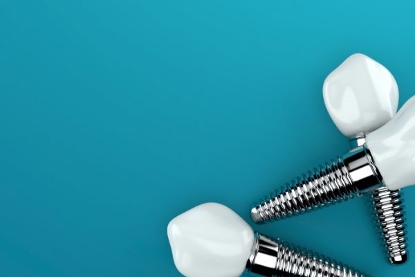 Implant dentaire - Dental Implant - Centre dentaire Dre Nathalie Kadoch à LaSalle (1)