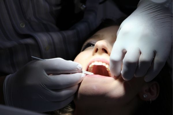 Restauration dentaire - Dental restauration - Centre dentaire Nathalie Kadoch a LaSalle (2)