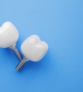 Implant dentaire - dental implant / importance de remplacer une dent manquante